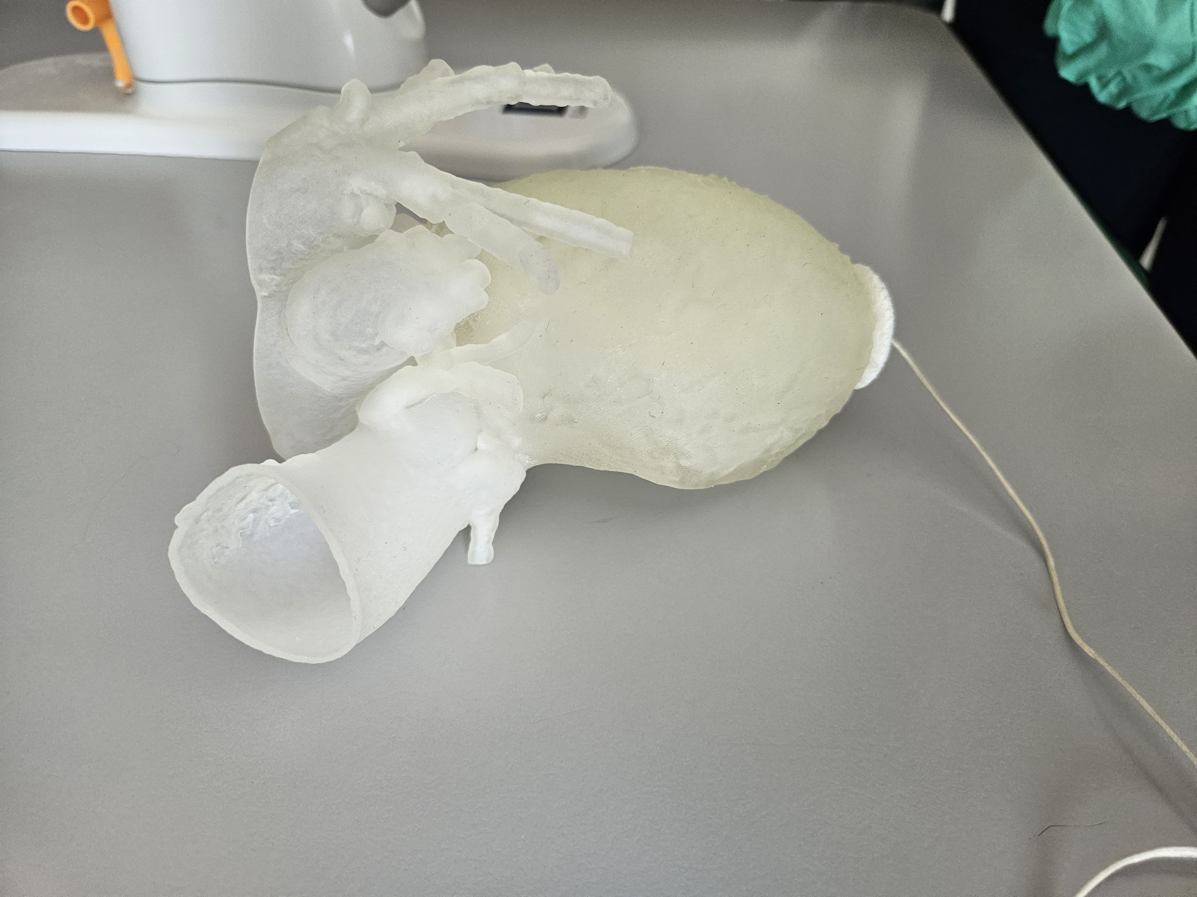 3D-printed patient heart